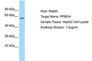 Image no. 1 for anti-Protein Phosphatase 1H (PP2C Domain Containing) (PPM1H) (AA 71-120) antibody (ABIN6750020) (PPM1H Antikörper  (AA 71-120))