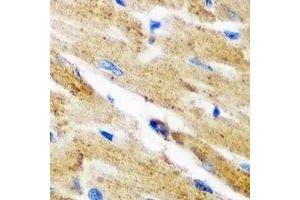 Immunohistochemical analysis of Kynureninase staining in mouse heart formalin fixed paraffin embedded tissue section.