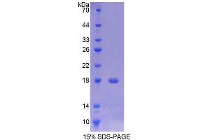 SDS-PAGE analysis of Rat TMEM27 Protein. (TMEM27 Protein)
