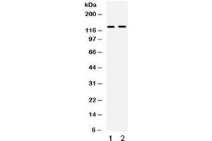 Western blot testing of 1) mouse spleen and 2) SW620 lysate with TRPM4 antibody.
