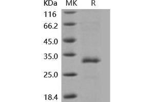 Western Blotting (WB) image for Mannose-Binding Lectin (Protein A) 1 (Mbl1) (Active) protein (His tag) (ABIN7320455)