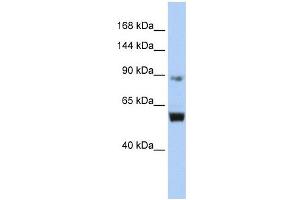 MCM10 antibody used at 1 ug/ml to detect target protein. (MCM10 Antikörper  (Middle Region))