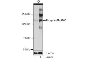 Western blot analysis of extracts of C6 cells, using Phospho-RB-S780 Rabbit mAb (ABIN7269936) at 1:1000 dilution. (Retinoblastoma 1 Antikörper  (pSer780))
