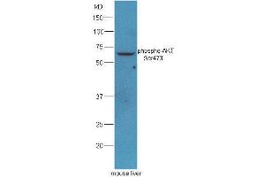 Mouse liver lysates probed with Rabbit Anti-AKT(Ser473) Polyclonal Antibody, Unconjugated  at 1: 5000 for 90min at 37˚C. (AKT 1/2/3 Antikörper  (pSer473))