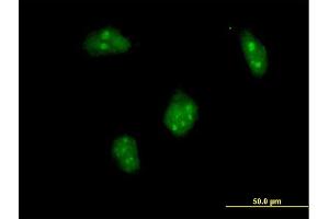 Immunofluorescence of purified MaxPab antibody to DLX1 on HeLa cell.