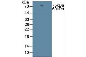 Detection of CHRNa4 in Human U-87MG Cells using Polyclonal Antibody to Cholinergic Receptor, Nicotinic, Alpha 4 (CHRNa4) (CHRNA4 Antikörper  (AA 49-242))