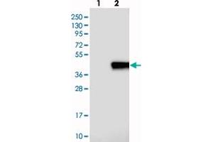 Western blot analysis of Lane 1: Negative control (vector only transfected HEK293T lysate), Lane 2: Over-expression Lysate (Co-expressed with a C-terminal myc-DDK tag (~3. (PLEKHF1 Antikörper)