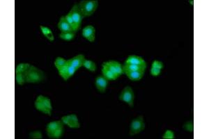 Immunofluorescence staining of HepG2 cells with ABIN7172879 at 1:266, counter-stained with DAPI. (TRPV2 Antikörper  (AA 1-117))