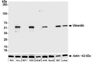 Western Blotting (WB) image for anti-Vimentin (VIM) (AA 325-375) antibody (ABIN7449539) (Rekombinanter Vimentin Antikörper  (AA 325-375))