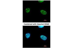 ICC/IF Image Immunofluorescence analysis of paraformaldehyde-fixed HeLa, using WTAP, antibody at 1:500 dilution. (WTAP Antikörper  (Center))