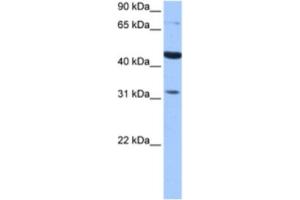 Western Blotting (WB) image for anti-Tetra-Peptide Repeat Homeobox-Like (TPRXL) antibody (ABIN2463460) (TPRXL Antikörper)