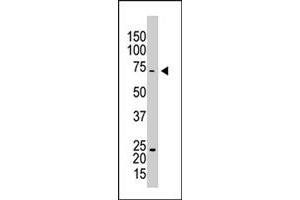 The CAPRIN1 polyclonal antibody  is used in Western blot to detect CAPRIN1 in HL-60 cell lysate . (Caprin-1 Antikörper  (AA 625-654))