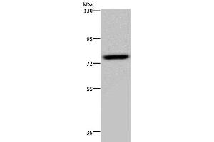 Western Blot analysis of PC3 cell using NR4A1 Polyclonal Antibody at dilution of 1:200 (NR4A1 Antikörper)