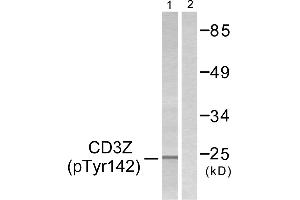 Western blot analysis of extracts from Jurkat cells, treated with UV (15mins), using CD3 ζ (Phospho-Tyr142) antibody. (CD247 Antikörper  (pTyr142))