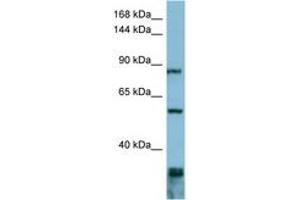 Image no. 1 for anti-Epidermal Growth Factor Receptor Pathway Substrate 8 (EPS8) (AA 647-696) antibody (ABIN6741834) (EPS8 Antikörper  (AA 647-696))