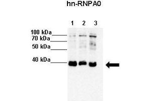 Lanes :  Lane 1: 20ug HeLa S3 lysate Lane 2: 20ug MCF7 lysate Lane 3: 20ug K562 lysate   Primary Antibody Dilution :   1:4000    Secondary Antibody :  Anti-rabbit-HRP   Secondary Antibody Dilution :   1:5000   Gene Name :  HNRPA0   Submitted by :  Anonymous (HNRNPA0 Antikörper  (Middle Region))