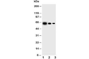 Western blot testing of IL23 p19 antibody and Lane 1:  recombinant mouse protein 10ng;  2: 5ng;  3: 2. (IL23A Antikörper  (N-Term))