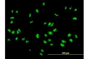 Immunofluorescence of purified MaxPab antibody to RSL1D1 on HeLa cell. (RSL1D1 Antikörper  (AA 1-490))
