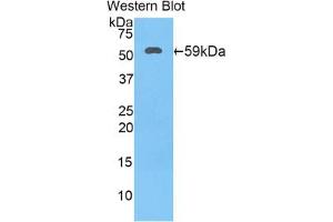 Western blot analysis of the recombinant protein. (HSD17B12 Antikörper  (AA 11-291))