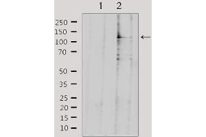 Western Blotting (WB) image for anti-serologically Defined Colon Cancer Antigen 1 (SDCCAG1) (C-Term) antibody (ABIN6259616)