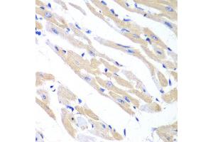 Immunohistochemistry of paraffin-embedded mouse heart using TRIM21 antibody at dilution of 1:100 (x40 lens). (TRIM21 Antikörper)