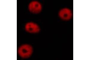 F7376 staining HEPG2 cells by ICC/IF. (DNMT1 Antikörper  (Internal Region))