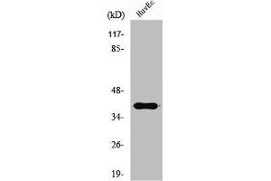 Western Blot analysis of HuvEc cells using Gads Polyclonal Antibody (GRAP2 Antikörper  (Internal Region))