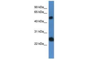 Image no. 1 for anti-Src-like-adaptor 2 (SLA2) (AA 66-115) antibody (ABIN6746842) (SLAP2 Antikörper  (AA 66-115))