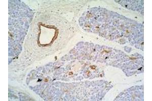 Immunohistochemistry of paraffin-embedded sections (pancreas) Immunohistochemistry staining of pancreas (paraffin-embedded sections) with anti-Cytokeratin 7+17 (C-46). (Keratin 7/17 Antikörper)