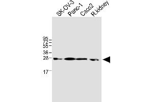 All lanes : Anti-TMEM97 Antibody (N-term) at 1:1000 dilution Lane 1: SK-OV-3 whole cell lysate Lane 2: Panc-1 whole cell lysate Lane 3: Caco2 whole cell lysate Lane 4: rat kidney lysate Lysates/proteins at 20 μg per lane.