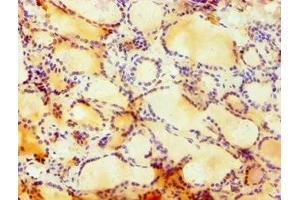 Immunohistochemistry of paraffin-embedded human thyroid tissue using ABIN7148757 at dilution of 1:100 (Cullin 4B Antikörper  (AA 1-200))