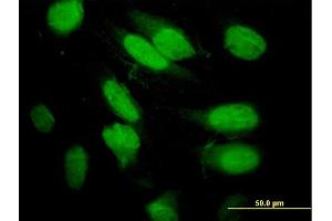 Immunofluorescence of purified MaxPab antibody to SEPT2 on HeLa cell. (Septin 2 Antikörper  (AA 1-361))