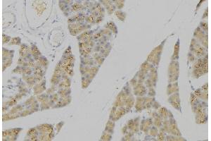 ABIN6276634 at 1/100 staining Human pancreas tissue by IHC-P. (PLA2G2A Antikörper  (Internal Region))