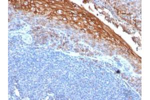 Image no. 1 for anti-Melanoma Cell Adhesion Molecule (MCAM) antibody (ABIN6153528) (MCAM Antikörper)