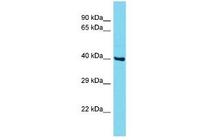 Host: Rabbit Target Name: CCDC86 Sample Type: MCF7 Whole Cell lysates Antibody Dilution: 1. (CCDC86 Antikörper  (N-Term))