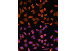 Immunofluorescence analysis of L929 cells using PLD3 Rabbit pAb (ABIN7269351) at dilution of 1:100. (PLD3 Antikörper)