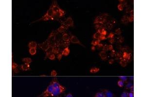Immunofluorescence analysis of HeLa cells using B4GALT4 Polyclonal Antibody at dilution of 1:100. (B4GALT4 Antikörper)
