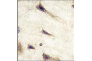 Immunohistochemistry (IHC) image for anti-EPH Receptor A5 (EPHA5) antibody (ABIN356398) (EPH Receptor A5 Antikörper)