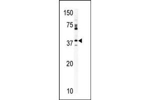 Western blot analysis of anti-CCRK Pab (ABIN391186 and ABIN2841280) in mouse kidney tissue lysate (35 μg/lane). (CCRK Antikörper  (N-Term))