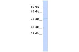WB Suggested Anti-MITF Antibody Titration:  0. (MITF Antikörper  (Middle Region))