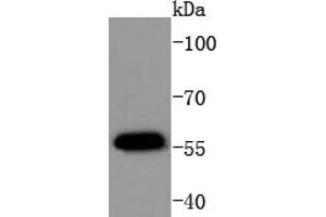 MCF-7 Cell lysates, probed with AKT1(T450) (4A3) Monoclonal Antibody  at 1:1000 overnight at 4˚C. (AKT1 Antikörper  (pThr450))