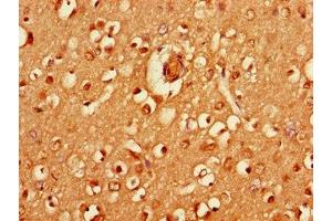 Immunohistochemistry of paraffin-embedded human brain tissue using ABIN7155237 at dilution of 1:100 (HRH3 Antikörper  (AA 236-332))