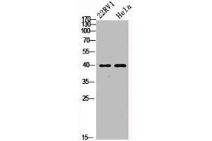 Western Blot analysis of 22RV1 HELA cells using PKAα/β/γ cat Polyclonal Antibody (PRKACA + PRKACB + PRKACG Antikörper)