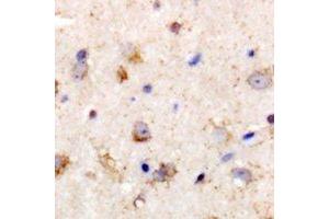 Immunohistochemical analysis of PGD2 synthase staining in rat brain formalin fixed paraffin embedded tissue section. (PTGDS Antikörper)