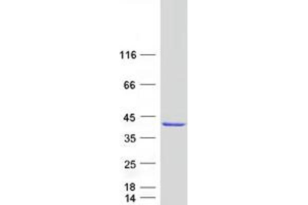 GIMAP7 Protein (Myc-DYKDDDDK Tag)