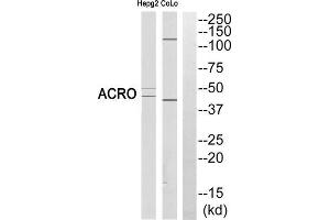 Western blot analysis of extracts from HEPG2 cells and COLO cells, using ACRO (heavy chain, Cleaved-Ile43) antibody. (Acrosin Antikörper  (Cleaved-Ile43, N-Term))