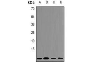 Western blot analysis of Cystatin A expression in HEK293T (A), Hela (B), NIH3T3 (C), mouse kidney (D) whole cell lysates. (CSTA Antikörper  (C-Term))