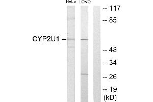Western blot analysis of extracts from HeLa cells and Lovo cells, using Cytochrome P450 2U1 antibody. (CYP2U1 Antikörper)