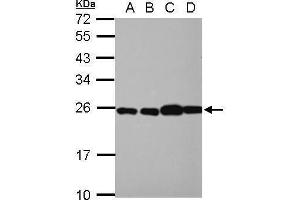 WB Image Sample (30 ug of whole cell lysate) A: NT2D1 B: PC-3 C: U87-MG D: SK-N-SH 12% SDS PAGE antibody diluted at 1:10000 (RPL29 Antikörper)