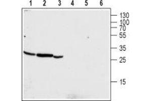 Western blot analysis of human pancreatic carcinoma PANC-1 (lanes 1 and 4), mouse kidney (lanes 2 and 5) and rat kidney (lanes 3 and 6) lysates: - 1-3. (CLIC4 Antikörper  (Intracellular, N-Term))